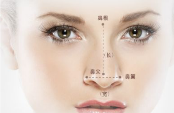 做"隆鼻"不用假体，单纯玻尿酸能垫高鼻梁吗？
