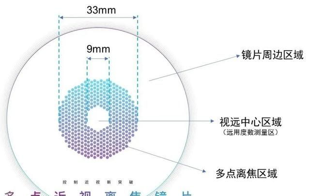 南石眼科医院丨近视防控镜片——豪雅新乐学