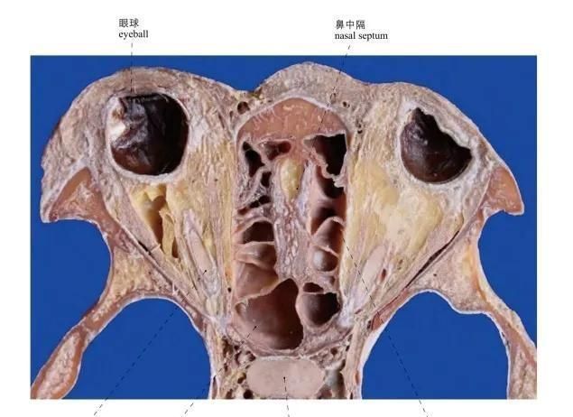 头部局部解剖学图谱