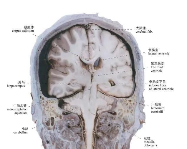 头部局部解剖学图谱