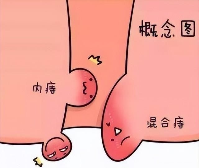讲一味侧柏叶，防脱发、生黑发、止鼻血、止咳喘、治痔疮之良药