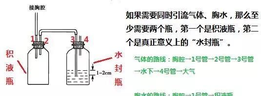 护士必看：胸腔闭式引流护理，这些细节不容小觑