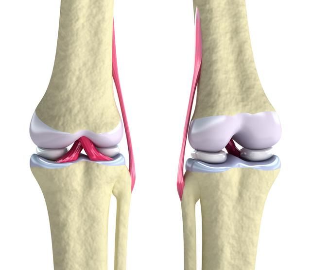 半月板在哪，为何年轻人半月板总受伤？医生：“小地方”可别小看