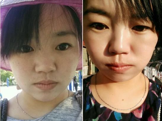 女孩儿香蕉到底是怎么用的？不仅自己用，还能祛痘祛斑美白皮肤