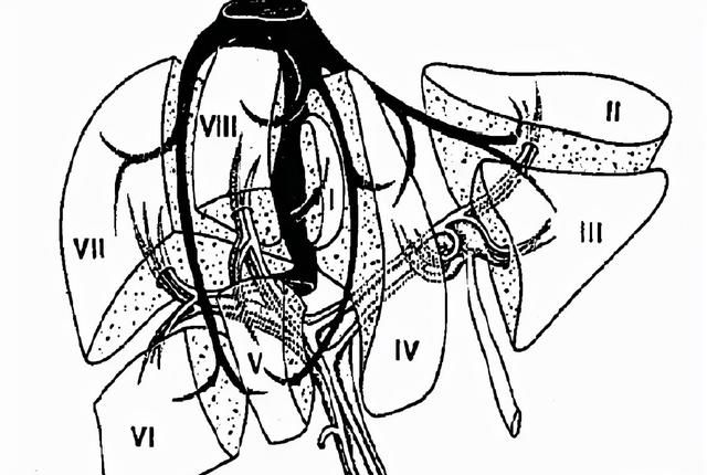 最全总结 | 肝脏的表面解剖及分叶分段，太赞了