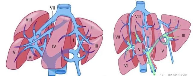 最全总结 | 肝脏的表面解剖及分叶分段，太赞了