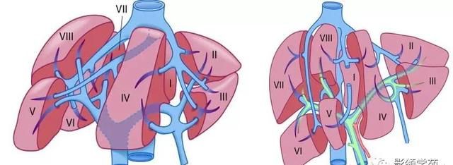 最全总结 | 肝脏的表面解剖及分叶分段，太赞了
