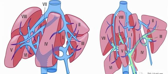 最全总结 | 肝脏的表面解剖及分叶分段，太赞了
