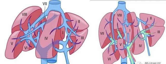 最全总结 | 肝脏的表面解剖及分叶分段，太赞了