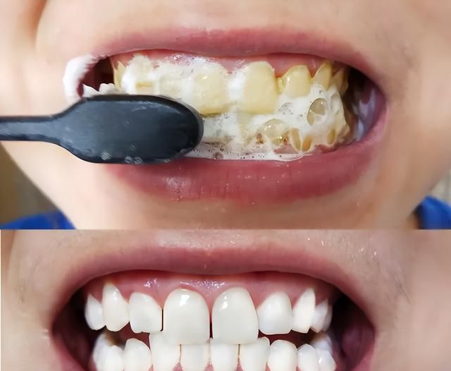 自用白牙牙膏牙粉分享！不用洗牙，在家就能有效白牙不反复