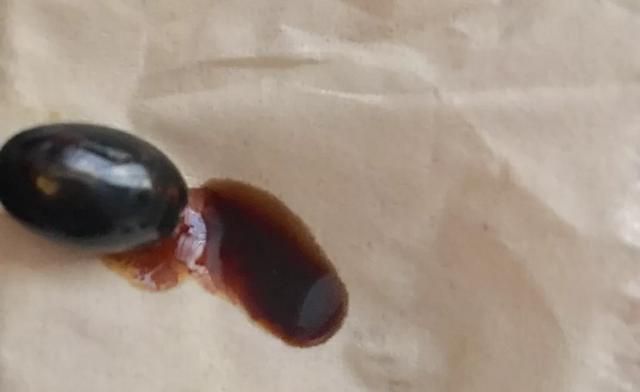 什么样的蜂胶不能服用图4