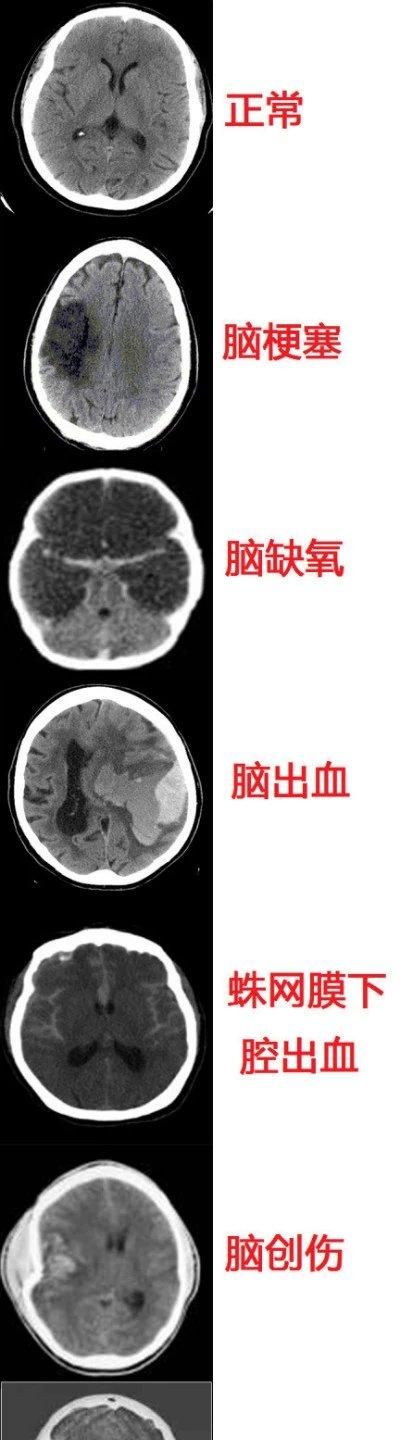 最全神经系统解剖图