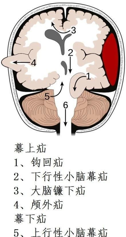 最全神经系统解剖图