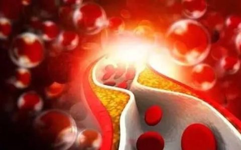 什么样的胆固醇是好胆固醇(总胆固醇高出多少算严重的血脂高)