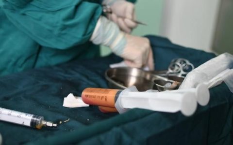 自体脂肪面部移植的优点有哪些