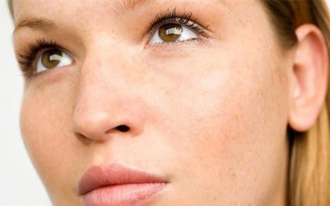 去除脸上长斑的小偏方(为什么激光祛斑后脸上斑更多了)