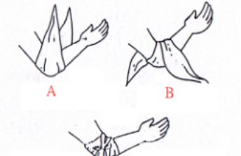 三角巾的包扎方法
