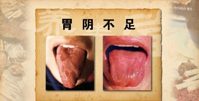 附子理中丸、理中丸、桂附理中丸有什么区别？最全用法都在这了！