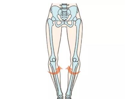 O型腿是如何形成的？有什么危害？如何改善O型腿，这套方法教你