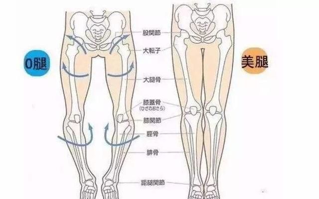 O型腿是如何形成的？有什么危害？如何改善O型腿，这套方法教你