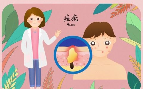痤疮是很常见的疾病,痤疮的治疗方法有什么区别