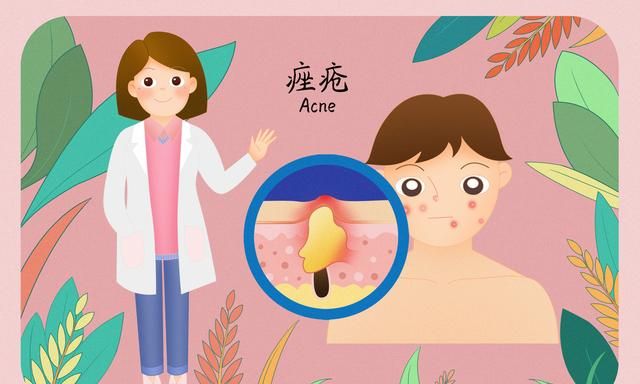 痤疮是很常见的疾病，痤疮的治疗方法有什么？