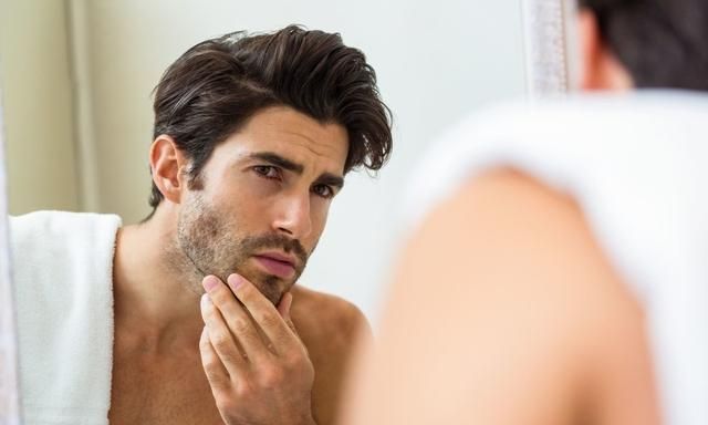 男生皮肤很粗糙怎么办 改善男士面部肤质方法