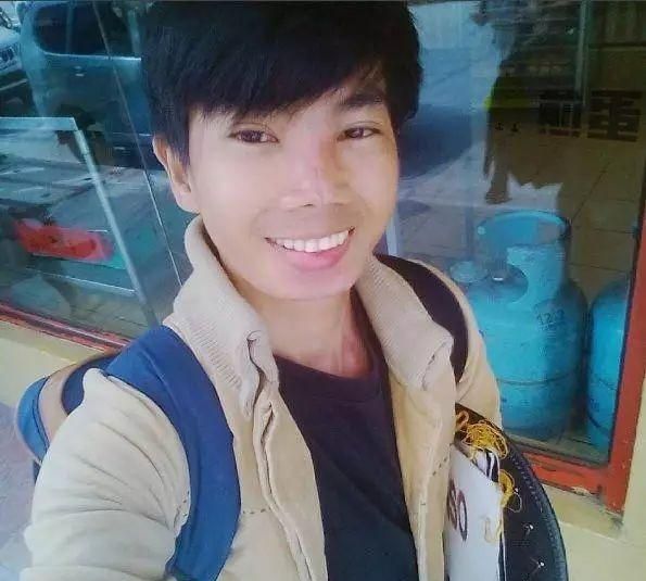 整容只花65块？菲律宾16岁男模亲测史上最低价整容
