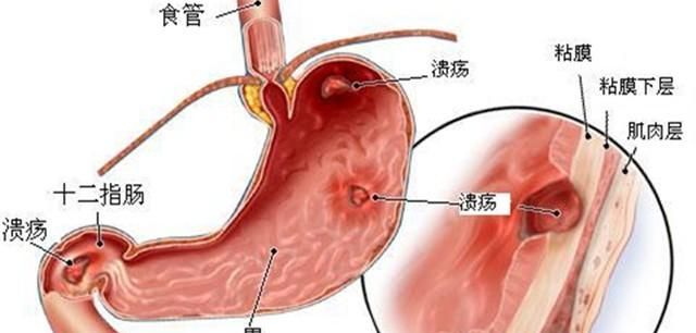 如何服用阿司匹林图4