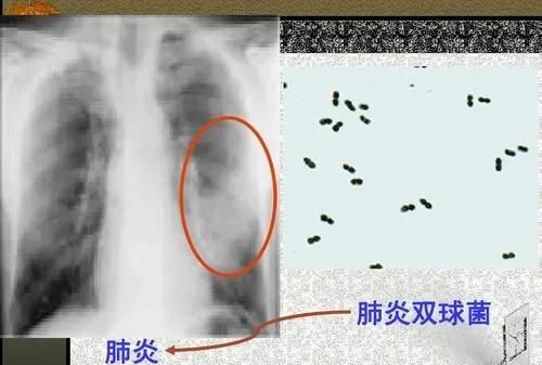 头孢克肟的功效副作用多久能好图4