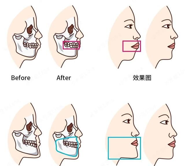 换头，了解一下？