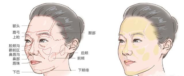 玻尿酸的作用和功效有哪些图7