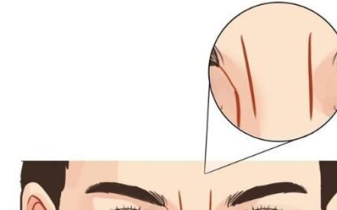 四种印堂纹路看你今生富贵贫贱(印堂纹路看富贵命还是劳碌命)