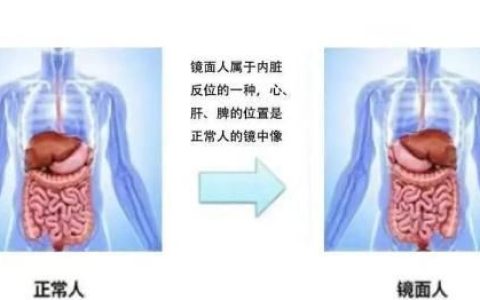 小孩内脏全部长反