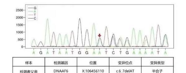 极为罕见！13岁女孩内脏全长反了