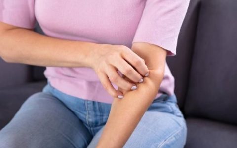 皮肤干燥脱屑像雪花怎么办