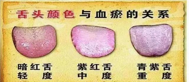 常灸大腿内侧2个穴位，活血化瘀，还淡斑、散结节，好处太多了