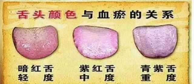 常灸大腿内侧2个穴位，活血化瘀，还淡斑、散结节，好处太多了