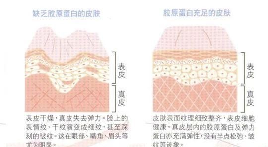 激光美白真的有用么？上周我去亲身体验了一次
