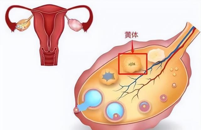 一天接诊了三个都是黄体破裂，黄体到底是什么？女性特别注意