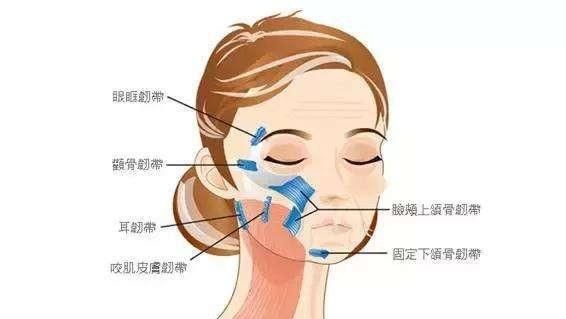 微创小切口面部提升，苹果肌下垂、法令纹明显的姐妹可以看看
