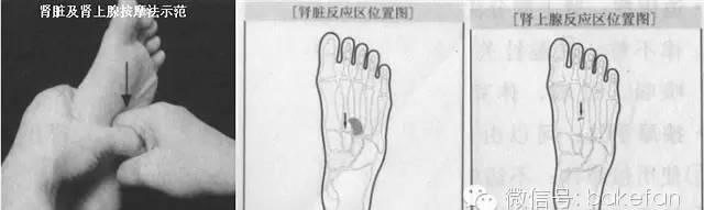 妇科最常见的疾病之一的----足部反射区按摩治疗法