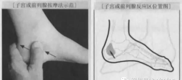 妇科最常见的疾病之一的----足部反射区按摩治疗法