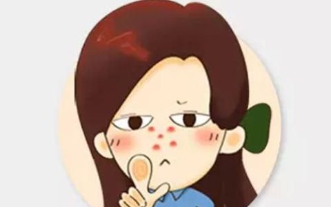 鼻子长痘痘应该怎么调理才能好