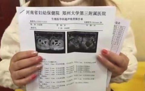 胎儿一斤等于多少克(女主生了四胞胎男主瘫痪重生小说)