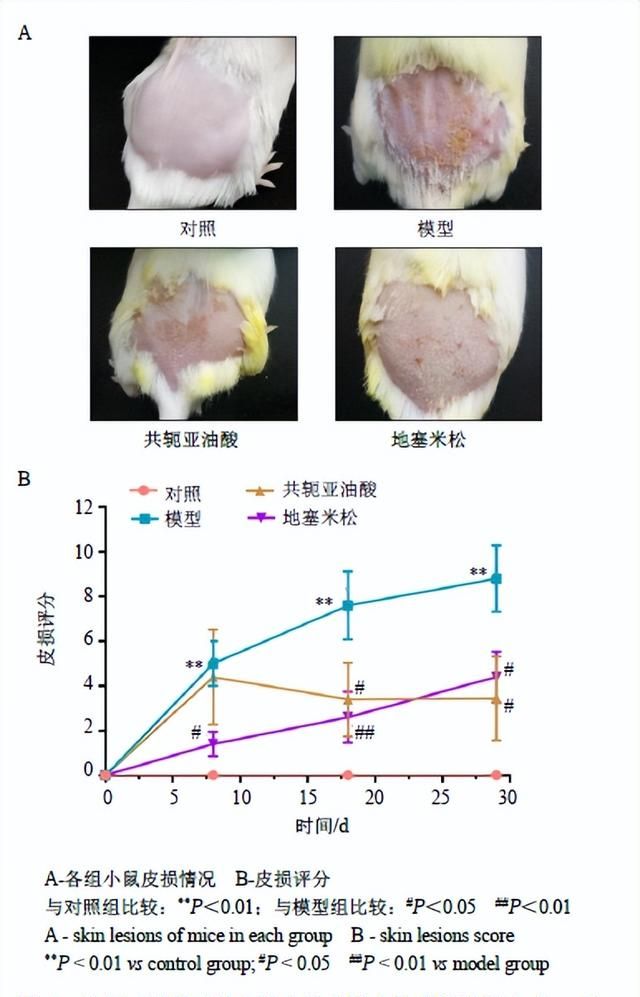 共轭亚油酸治疗特应性皮炎的作用机制研究