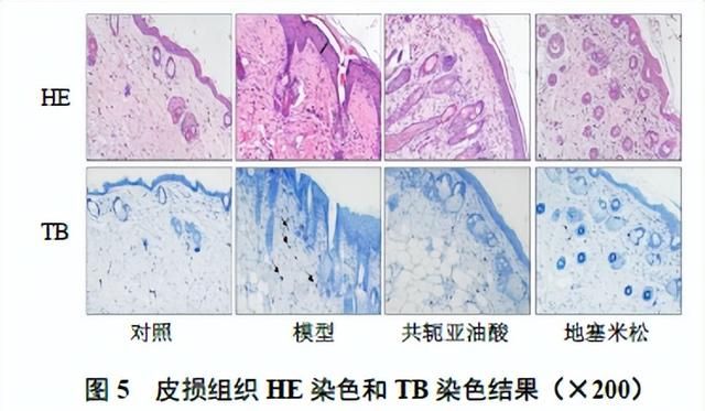 共轭亚油酸治疗特应性皮炎的作用机制研究