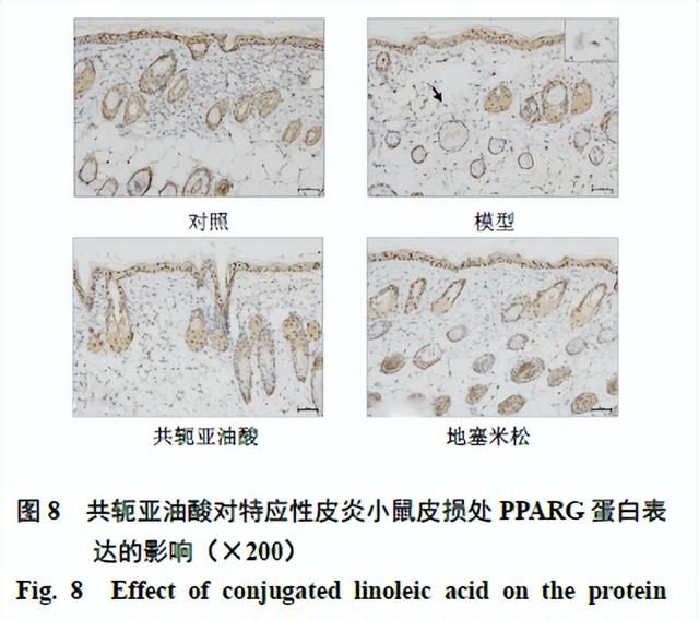 共轭亚油酸治疗特应性皮炎的作用机制研究