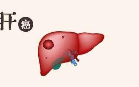 面色发黑警惕肝癌
