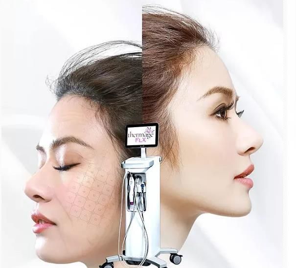 热玛吉的效果怎么样图4